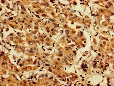 Polyclonal Rabbit anti-Human PDCD6 / ALG-2 Antibody (IHC, WB)