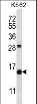 Polyclonal Rabbit anti-Human SCGB1D2 / Lipophilin B Antibody (aa22-50, WB)