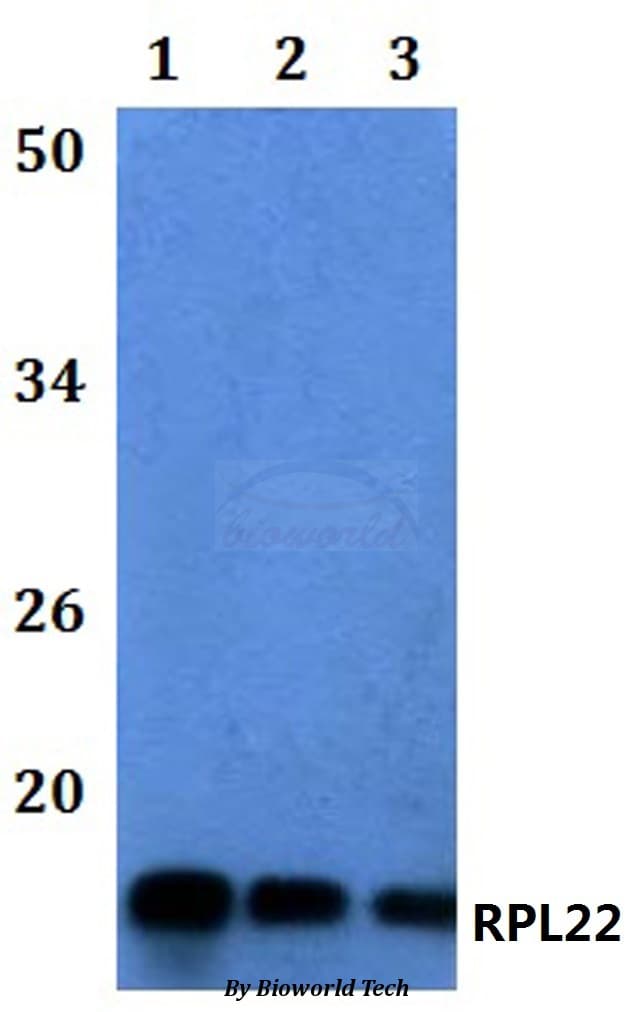 Polyclonal Rabbit anti-Human RPL22 / Ribosomal Protein L22 Antibody (WB)