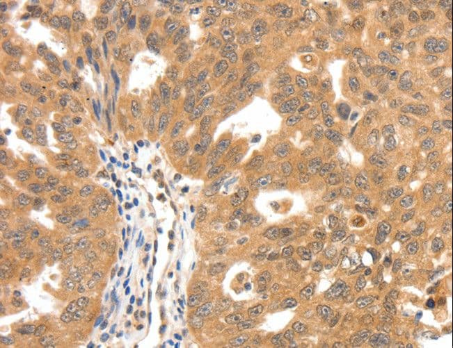 Polyclonal Rabbit anti-Human SCN5A / Nav1.5 Antibody (IHC)