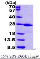 Human FKBP14 Protein (Recombinant His)