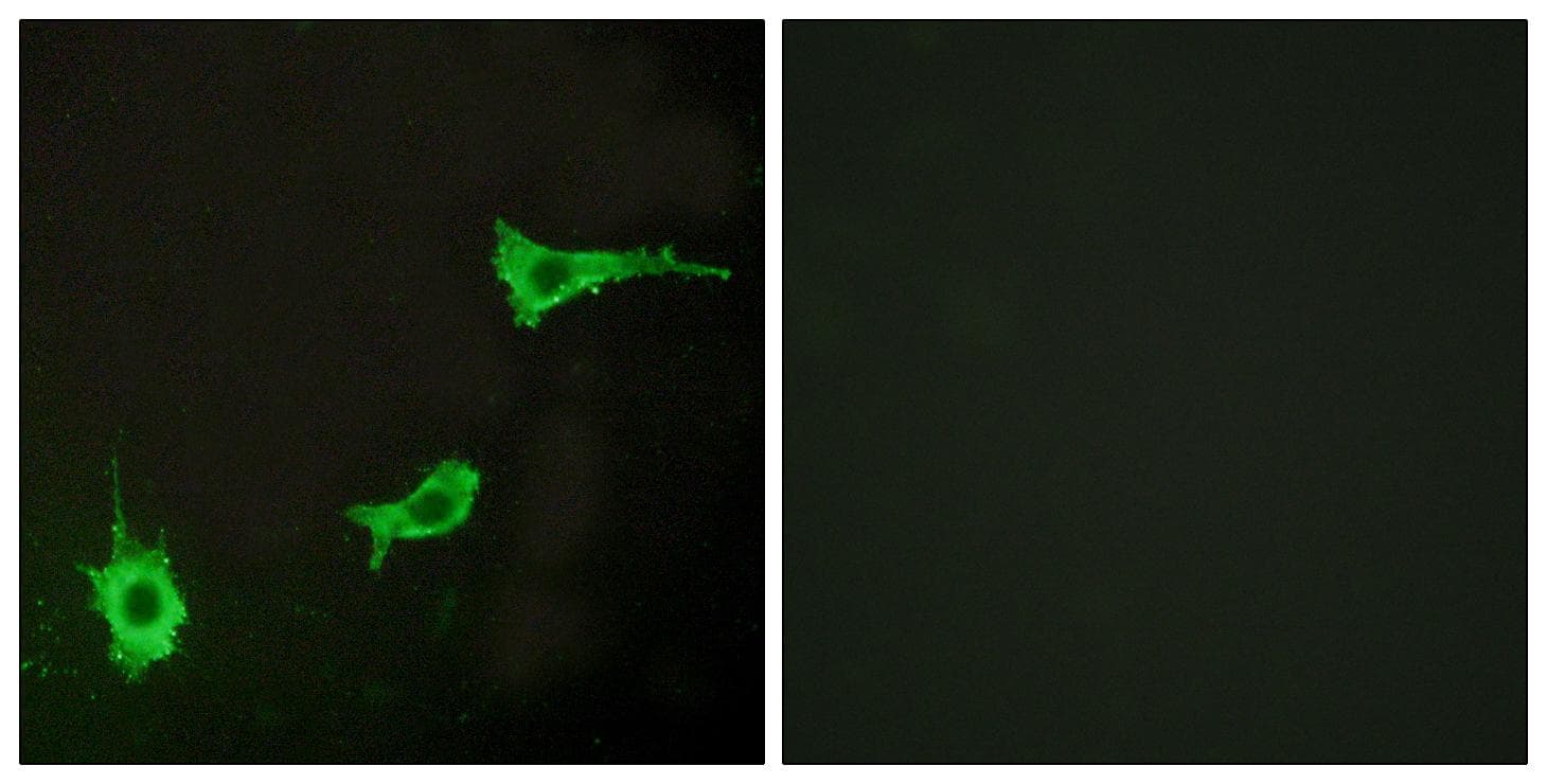 ADRA1B / Adrenoceptor alpha 1B Antibody