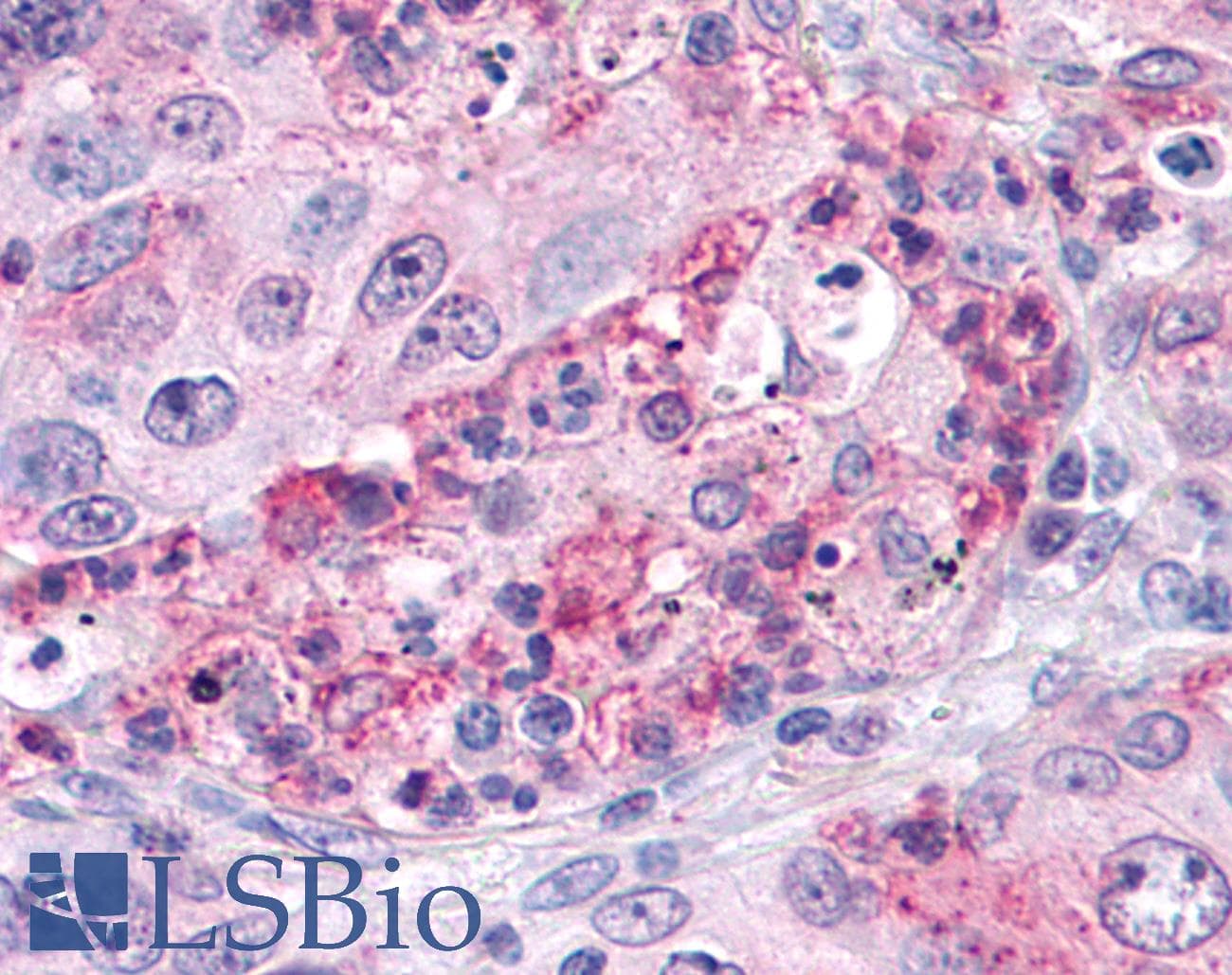 IHC-plus™ Polyclonal Rabbit anti-Human SGK3 Antibody (Internal, IHC)