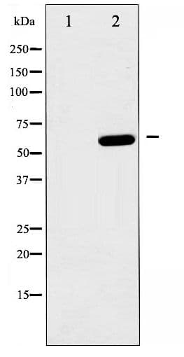 PRKAA1 / AMPK Alpha 1 Antibody (phospho-Ser485)