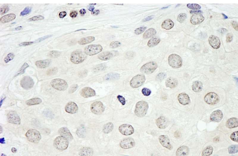 IHC-plus™ Polyclonal Rabbit anti-Human BRD2 / RING3 Antibody (aa675-725, IHC, IF, WB)