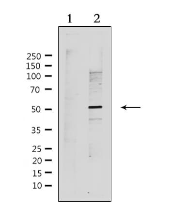 RAD51C Antibody