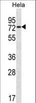 USP39 Antibody (aa237-265)