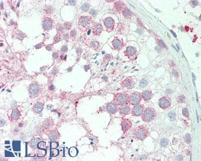 IHC-plus™ ARA9 / AIP Antibody (Internal)