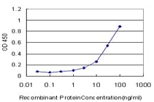 Monoclonal Mouse anti-Human PDHB Antibody (clone 2B2, IHC, WB)