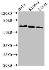 Polyclonal Rabbit anti-Human MLPH / Melanophilin Antibody (IHC, IF)
