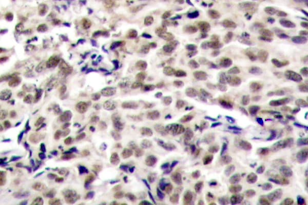 Polyclonal Rabbit anti-Human CREB1 / CREB Antibody (Lys123, IHC, WB)