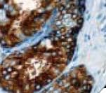 Alpha-Fetoprotein Antibody