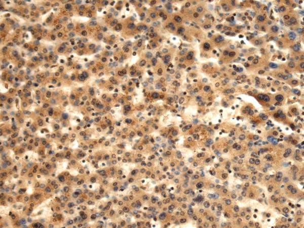 Polyclonal Rabbit anti-Human TMOD1 / Tropomodulin 1 Antibody (IHC)