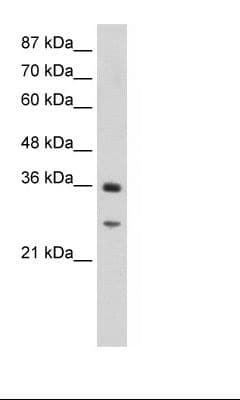 Polyclonal Rabbit anti-Human GIPC2 Antibody (N-Terminus, IHC, WB)