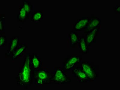 LIPE / HSL Antibody