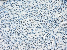 SLC2A5 / GLUT5 Antibody (clone OTI14C8)