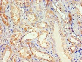 DVL2 / Dishevelled 2 Antibody (aa1-240)