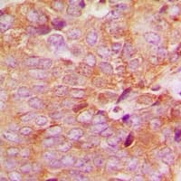 Polyclonal Rabbit anti-Human MAP2K6 / MEK6 / MKK6 Antibody (N-Terminus, IHC, IF, WB)