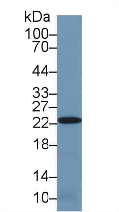PRDX2 / Peroxiredoxin 2 Antibody (aa6-164)