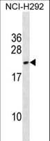 Polyclonal Rabbit anti-Human DYDC2 Antibody (aa137-163, WB)