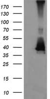 MAP2K3 / MEK3 / MKK3 Antibody (clone OTI4G4)