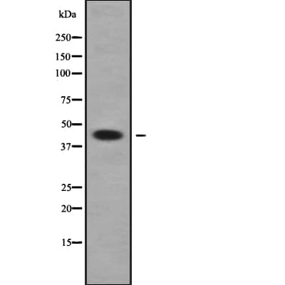 HSD2 / HSD11B2 Antibody