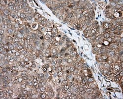 BTK Antibody (clone OTI6H9)