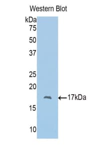 PBRM1 / BAF180 / PB1 Antibody (aa957-1086, Biotin)