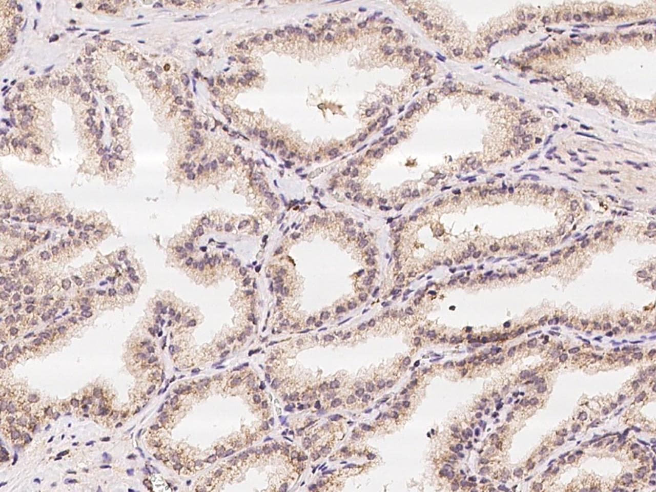 Polyclonal Rabbit anti-Human IBA57 / C1orf69 Antibody (IHC)