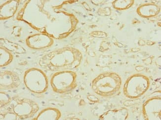 TEKT3 Antibody
