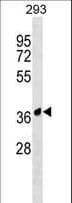 IHC-plus™ Polyclonal Rabbit anti-Human AMICA / JAML Antibody (aa43-72, IHC, WB)