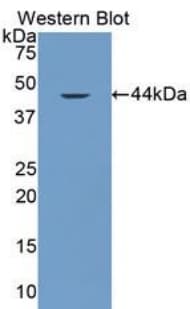 VCC-1 / CXCL17 Antibody (aa24-119, HRP)