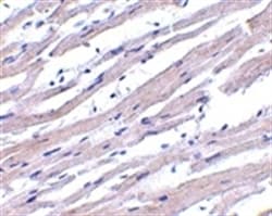 Polyclonal Rabbit anti-Human APAF1 / APAF-1 Antibody (aa12-28, IHC, WB)