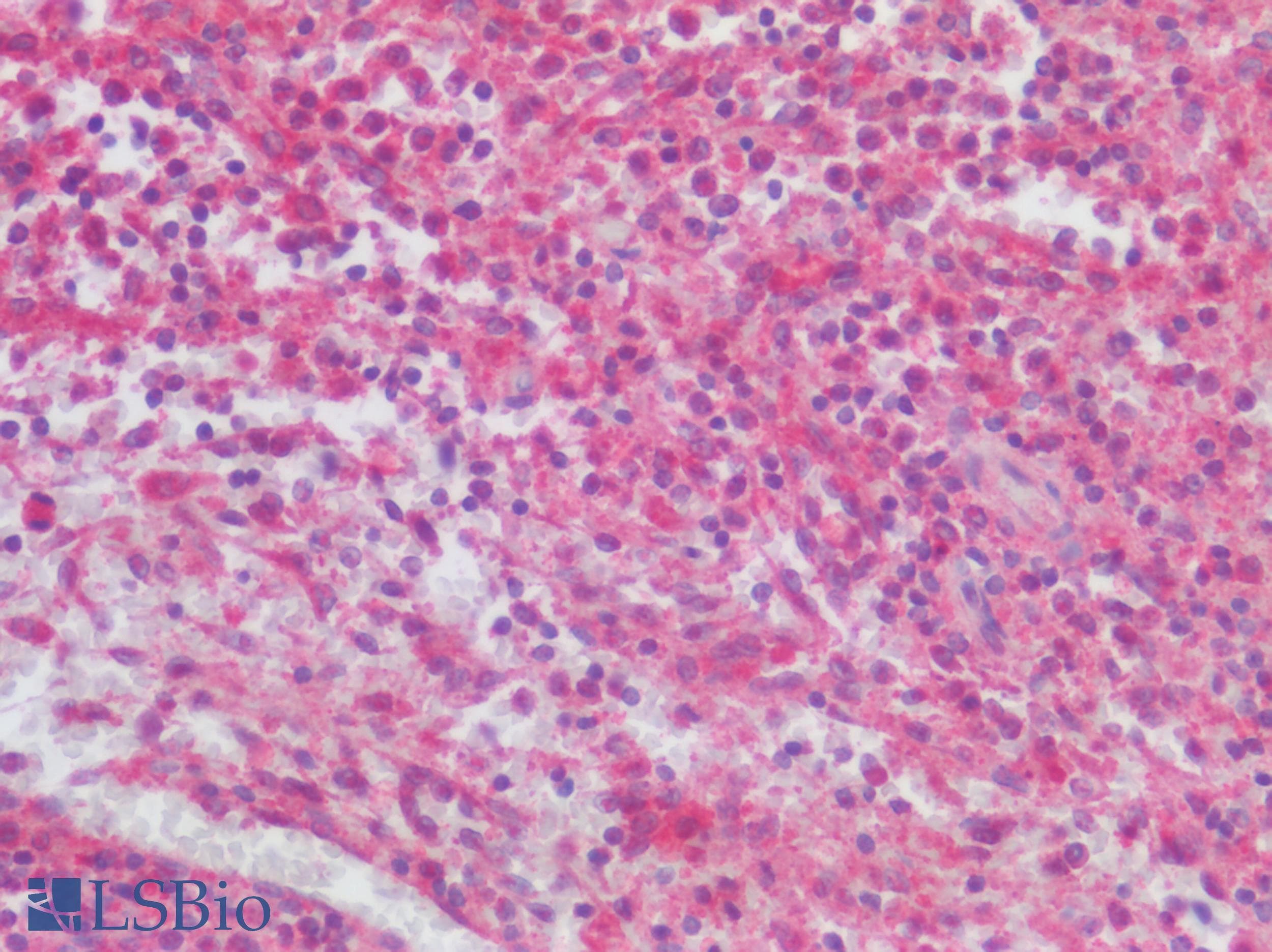 IHC-plus™ Polyclonal Rabbit anti-Human CCR2 Antibody (N-Terminus, IHC)