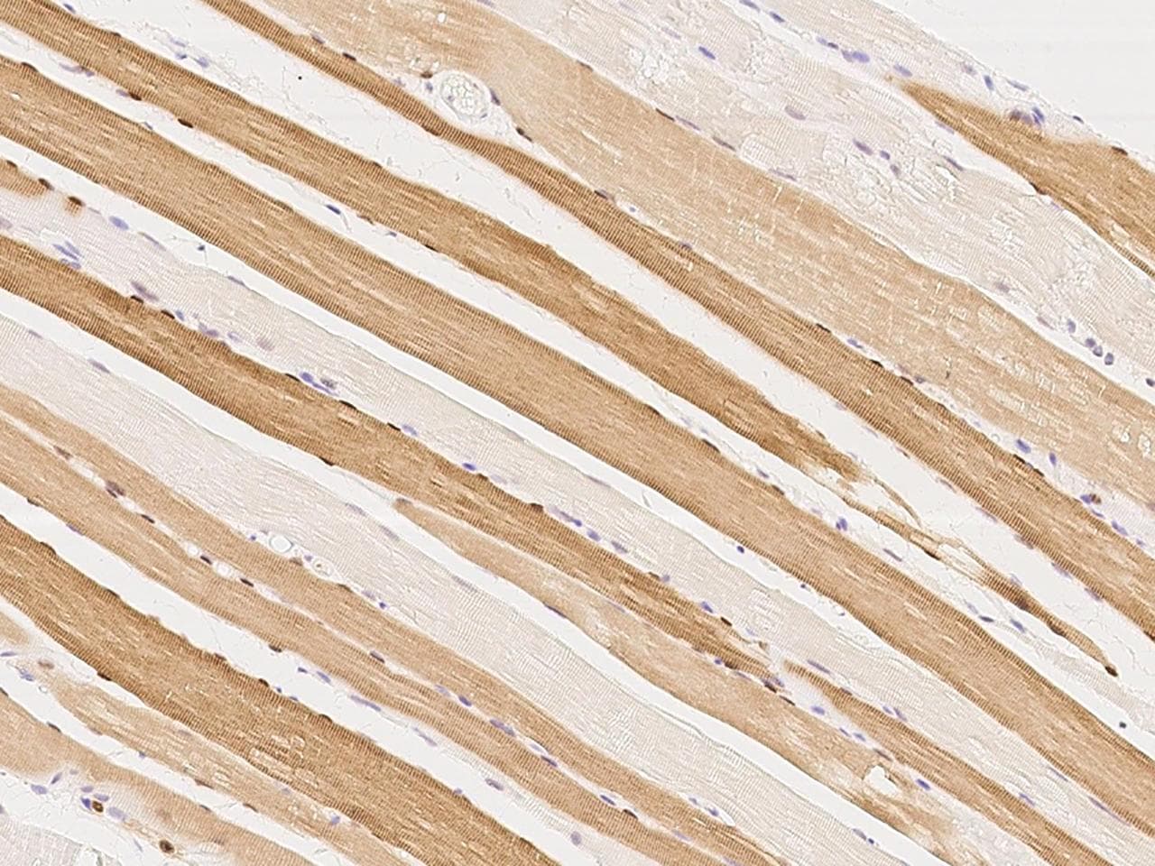 MAP2K3 / MEK3 / MKK3 Antibody (Preservative Free)
