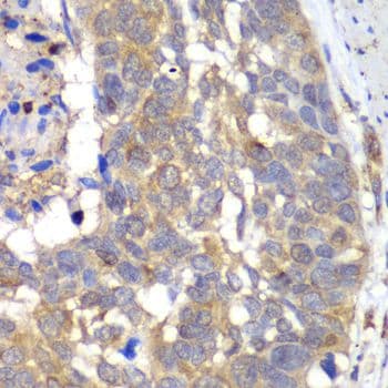 Polyclonal Rabbit anti-Human HAPLN1 Antibody (IHC, WB)