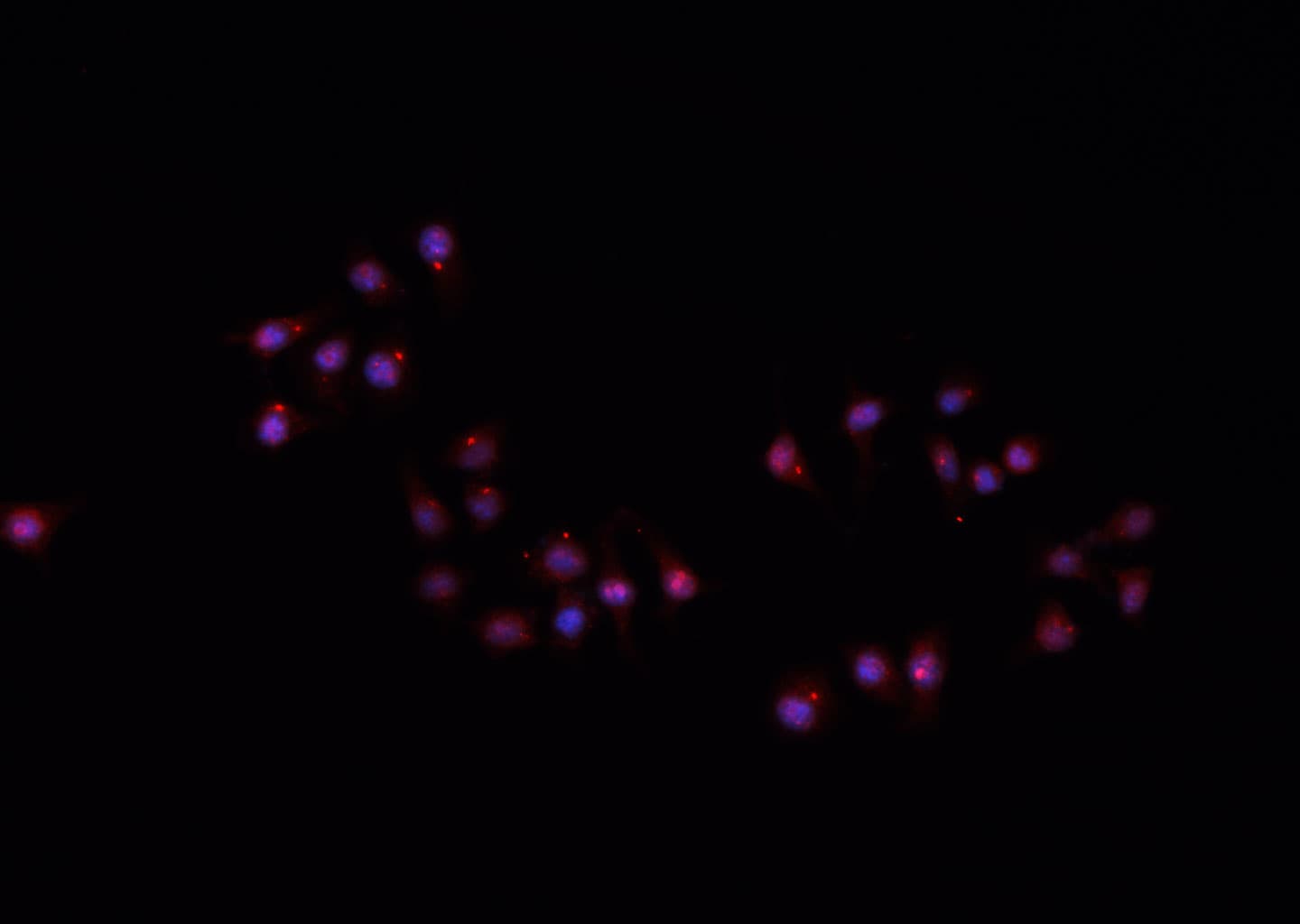 Polyclonal Rabbit anti-Human Hairless / HR Antibody (IHC, IF, WB)
