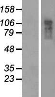 CCDC80 Protein (Over-Expression Lysate Myc-DDK (Flag))