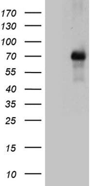 FOXO1 / FKHR Antibody (aa356-655, clone OTI8F12)