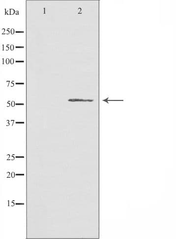 CHST2 Antibody