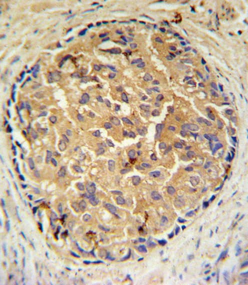Polyclonal Rabbit anti-Human SRD5A2L / SRD5A3 Antibody (aa283-311, IHC, WB)