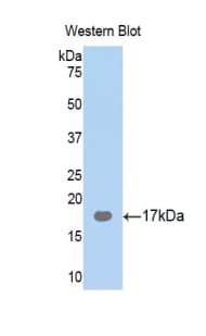 PPARG / PPAR Gamma Antibody (aa149-273, Biotin)