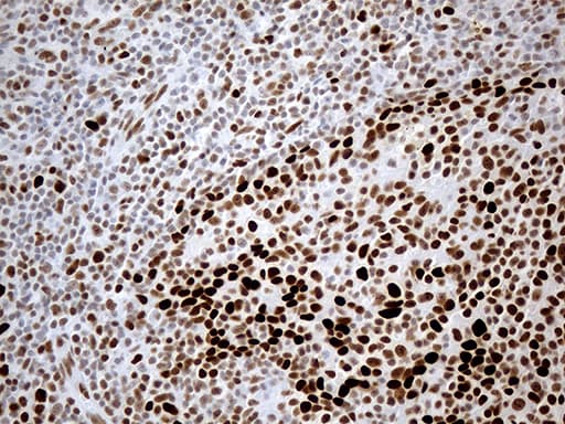 Monoclonal Mouse anti-Human RB1 / Retinoblastoma / RB Antibody (clone OTI11C10, aa309-590, IHC, WB)