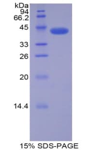 Rat CDK2 Protein (Recombinant His-GST)
