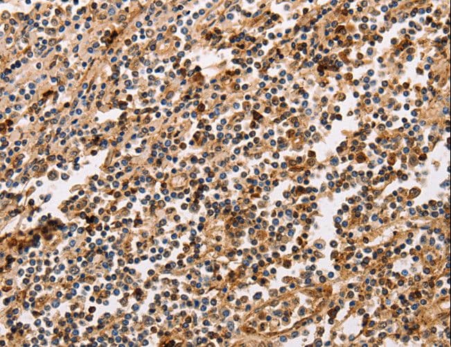 PPP1CB Antibody