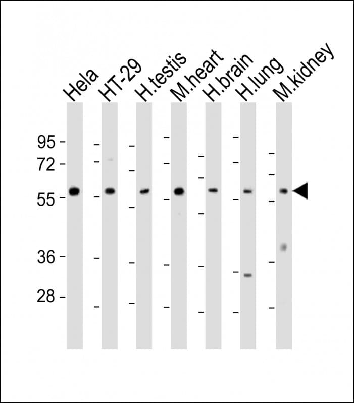 ER81 / ETV1 Antibody (aa434-465)