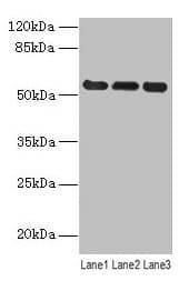 IHC-plus™ Vimentin Antibody (aa2-466)