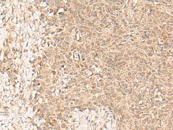FBXL4 / FBL5 Antibody