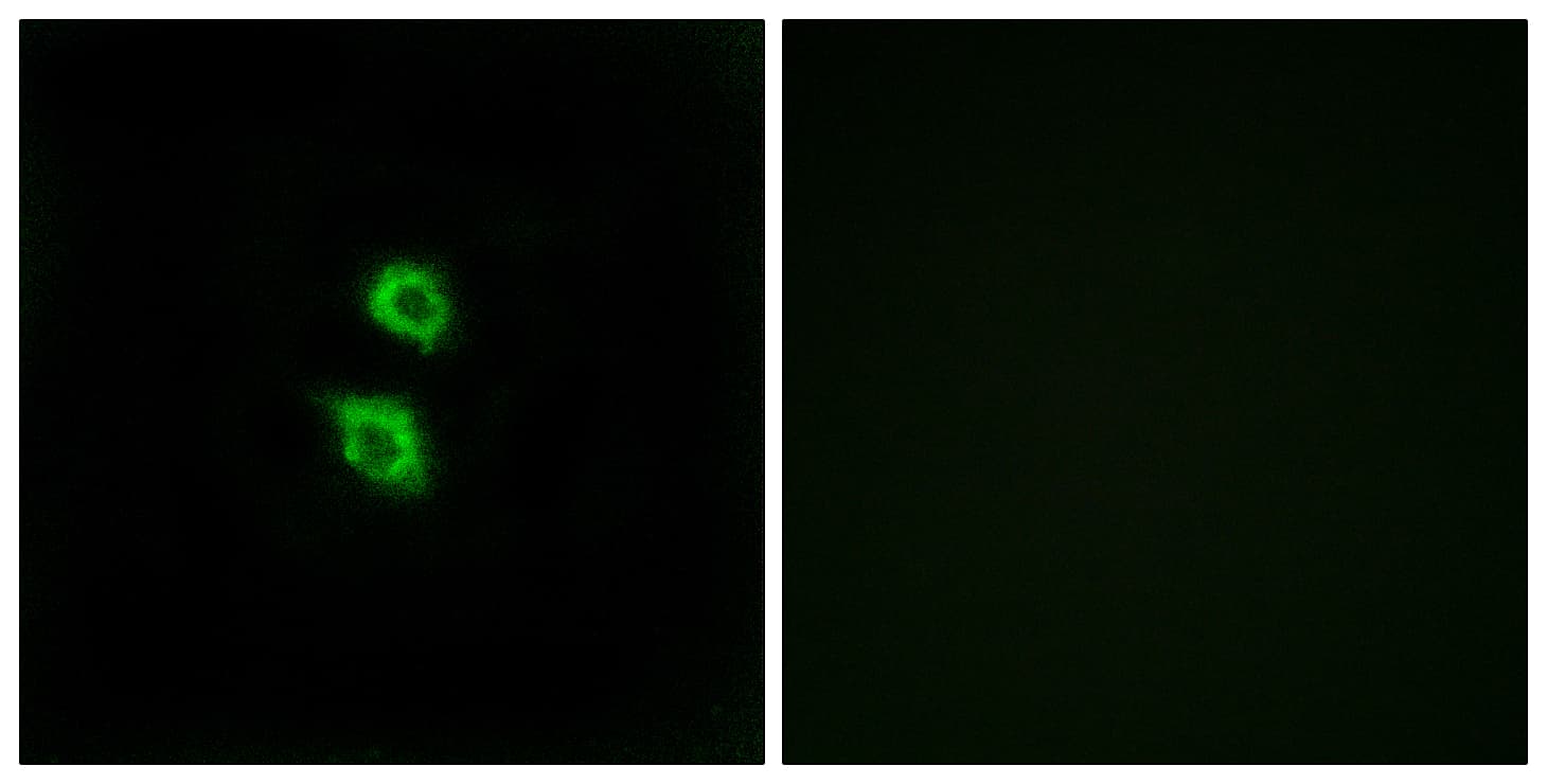 ARSD / Arylsulfatase D Antibody (aa331-380)
