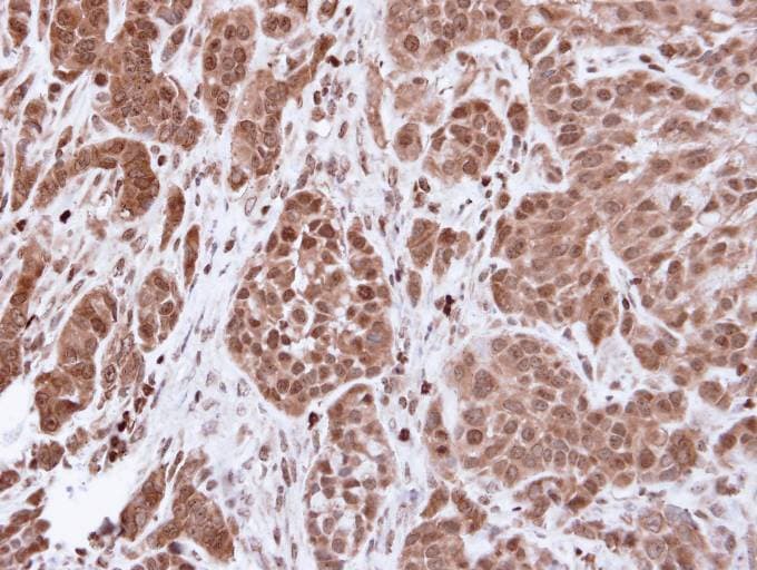 ACTN4 Antibody (aa206-542)